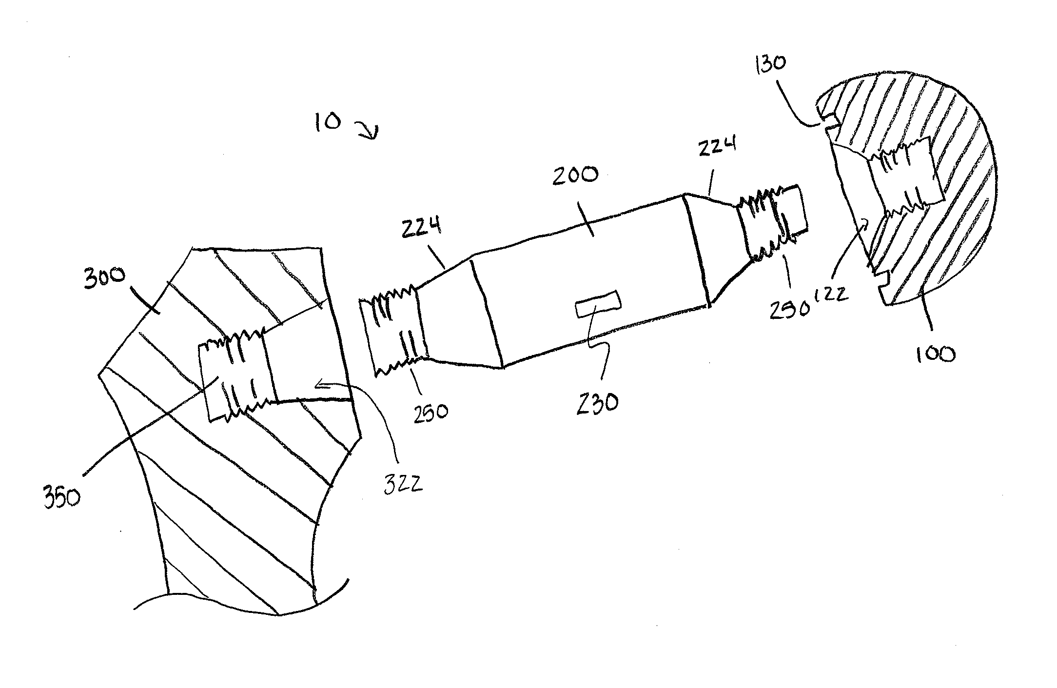 Method and apparatus for attachment in a modular hip replacement or fracture fixation device