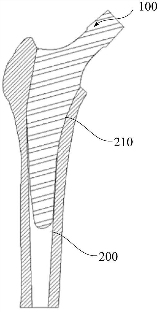 Femoral stem prosthesis and mounting method thereof