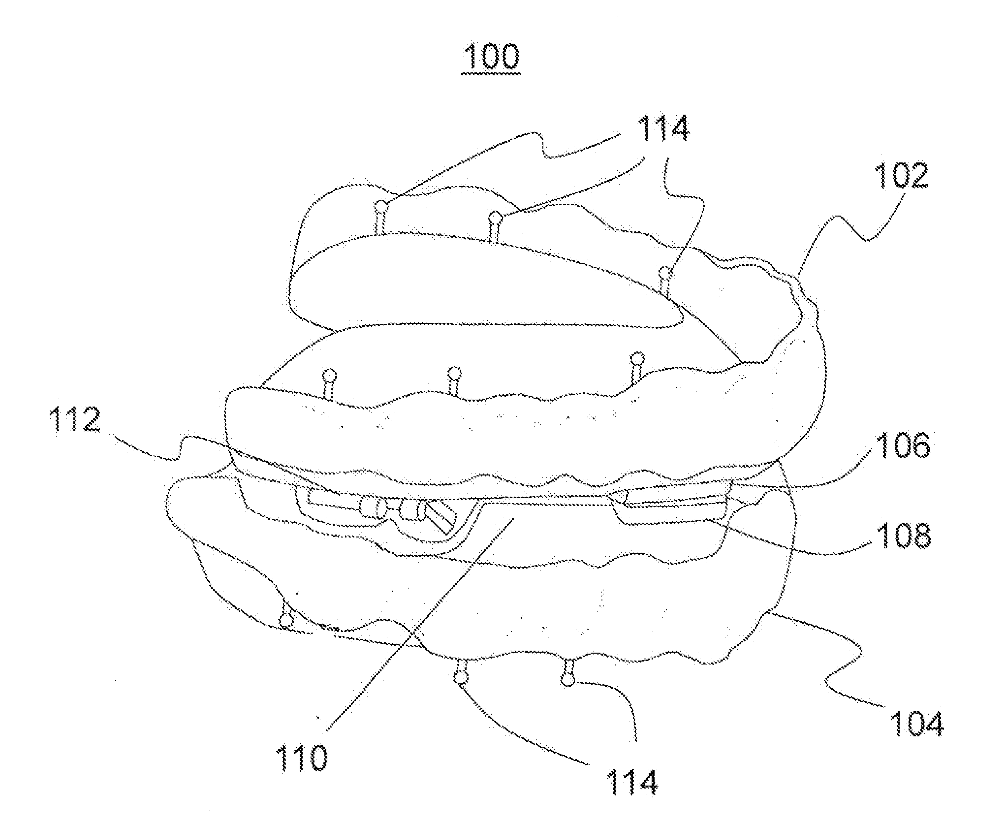 Adjustable mandibular advancement device