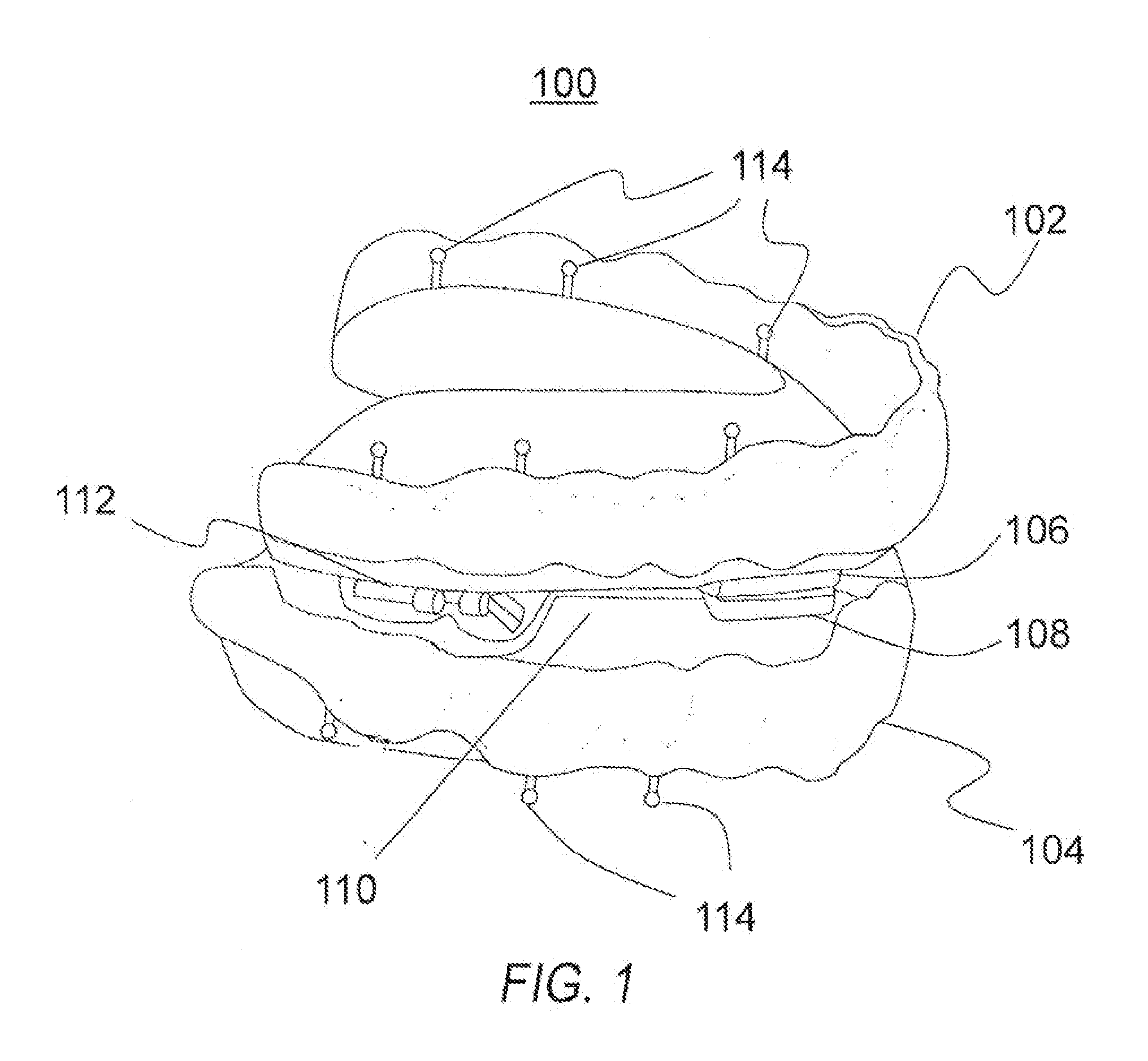 Adjustable mandibular advancement device