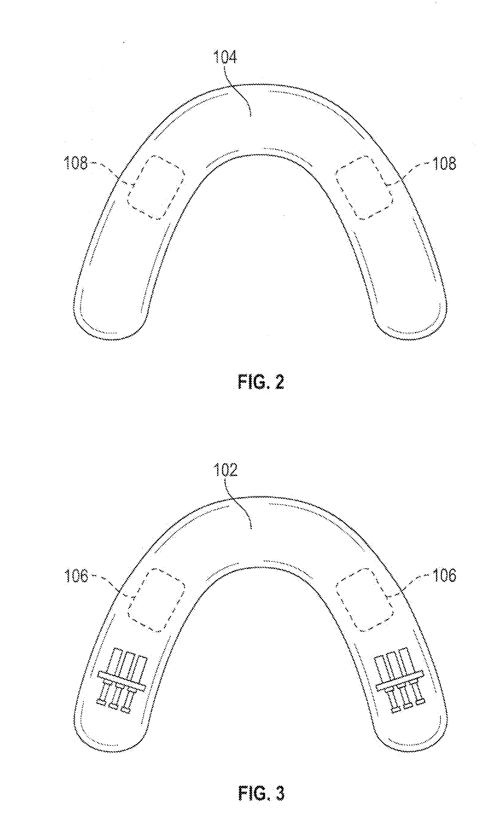 Adjustable mandibular advancement device