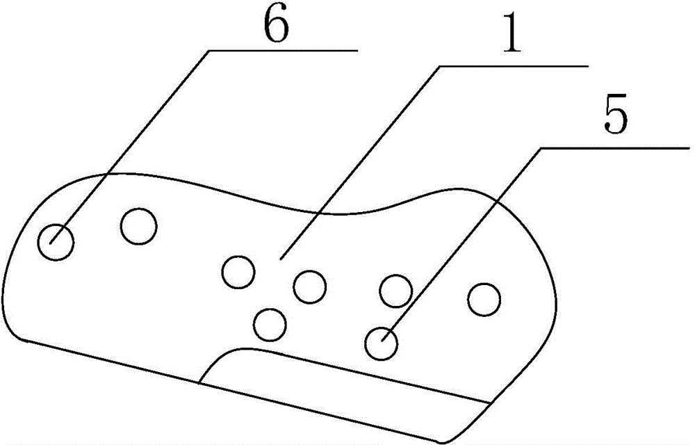 Artificial temporal-mandibular joint replacement bone trimming guide plate assembly