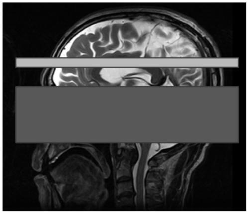 Cerebral perfusion weighted imaging method based on arterial spin labeling and variable delay time