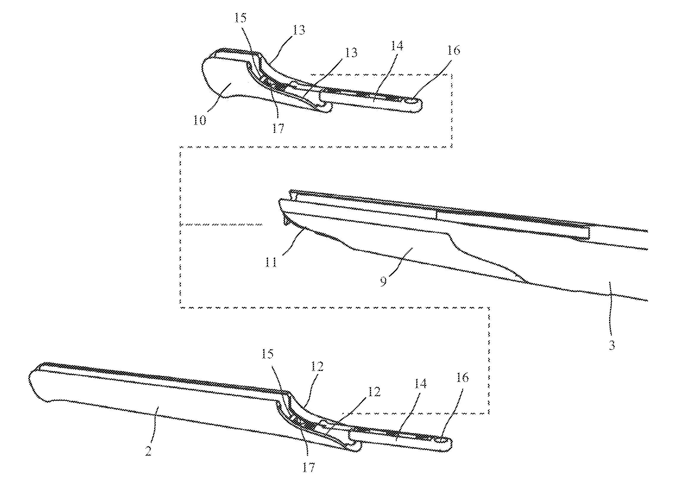 Stutzen stock