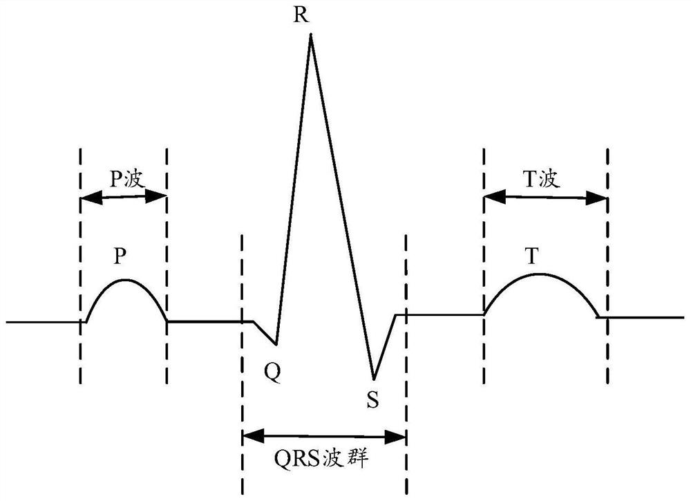 Electrocardiosignal processing method and device, terminal and storage medium