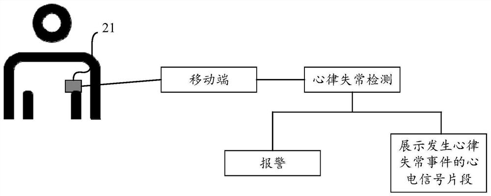 Electrocardiosignal processing method and device, terminal and storage medium