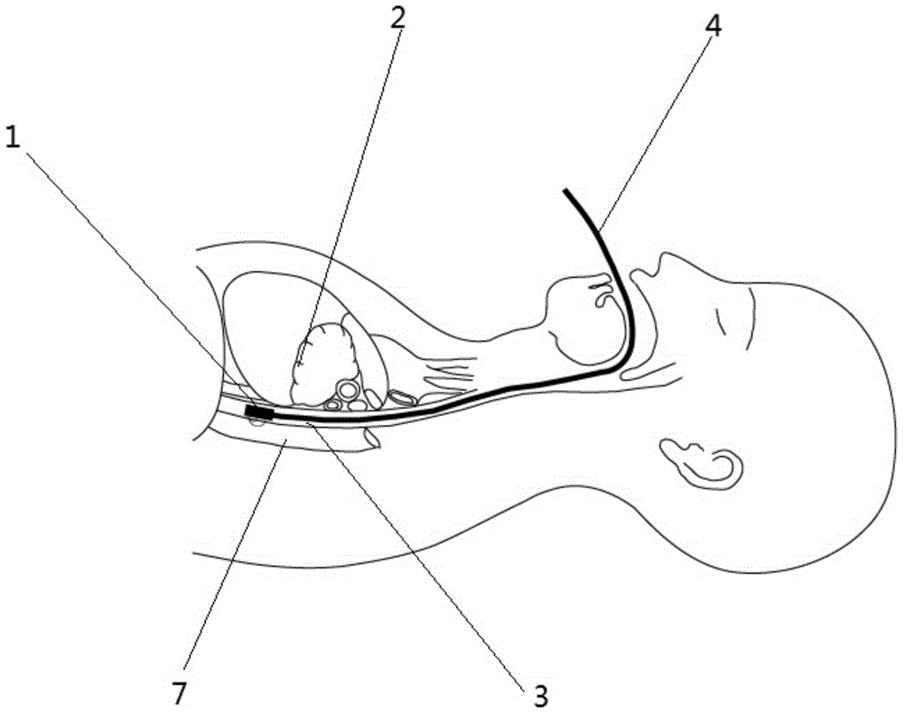 Method and device for monitoring oxygen supply parameters