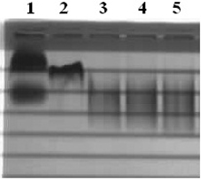 A kind of preparation method of high-purity low-density lipoprotein