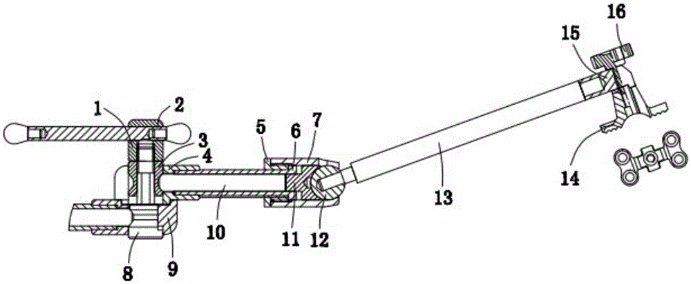 Outer mandible fixing bridge