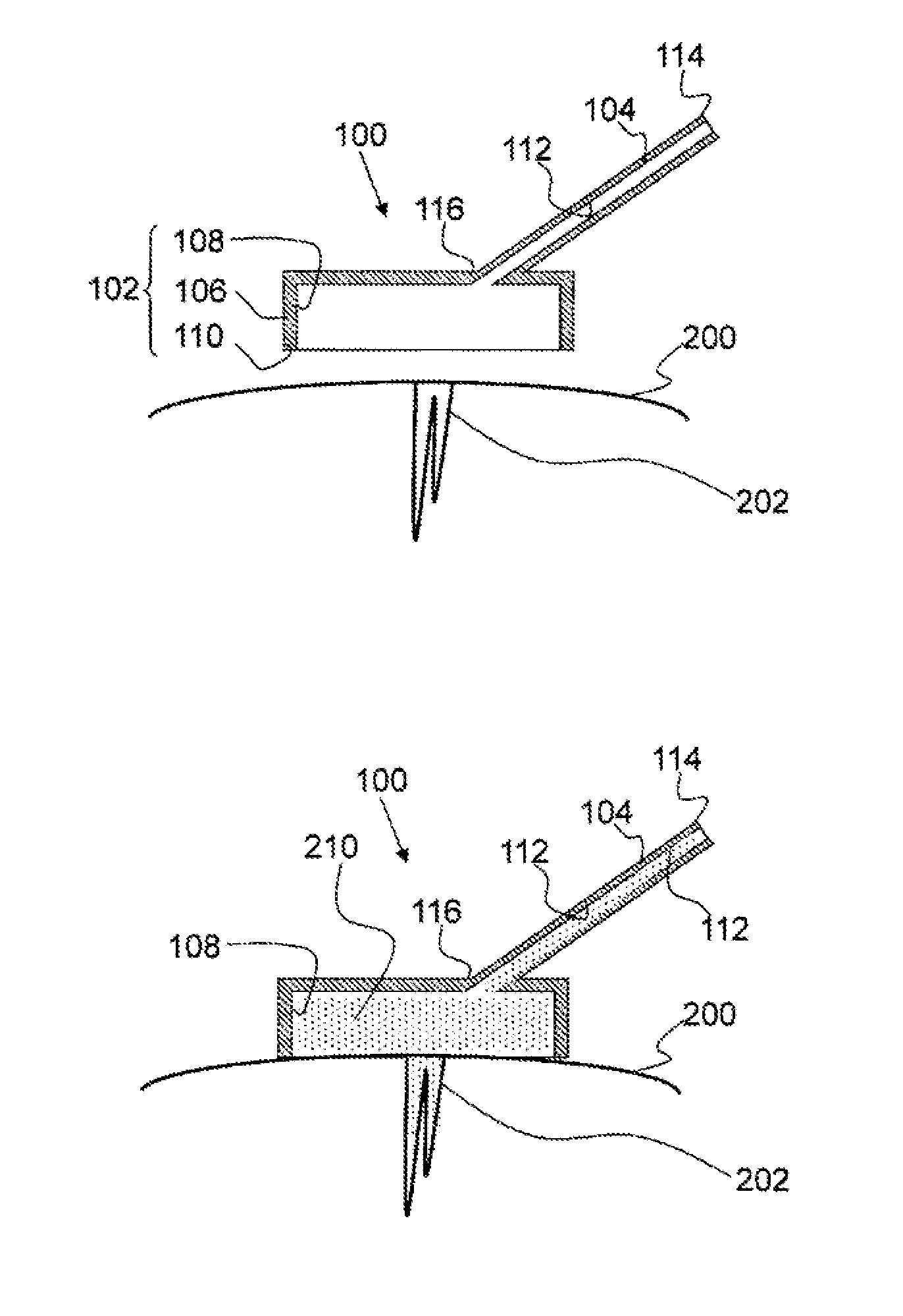 Hemostatic agent applicator