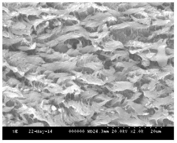 Gastrodin nasal starch microspheres with bioadhesive properties and preparation method thereof