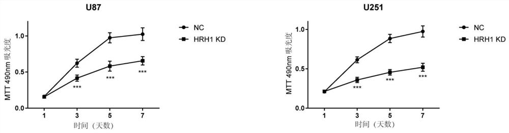 Applications of H1 histamine receptor antagonist in preparation of drugs for treating glioma