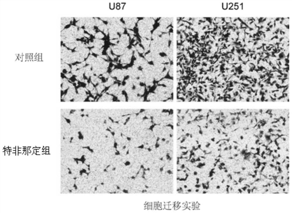 Applications of H1 histamine receptor antagonist in preparation of drugs for treating glioma