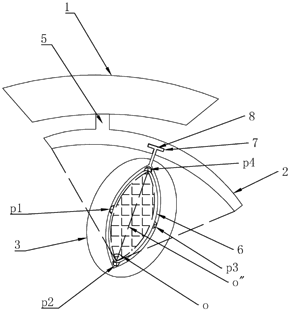 Positioning guide plate for removing unerupted supernumerary teeth in anterior tooth area, and manufacturing method thereof