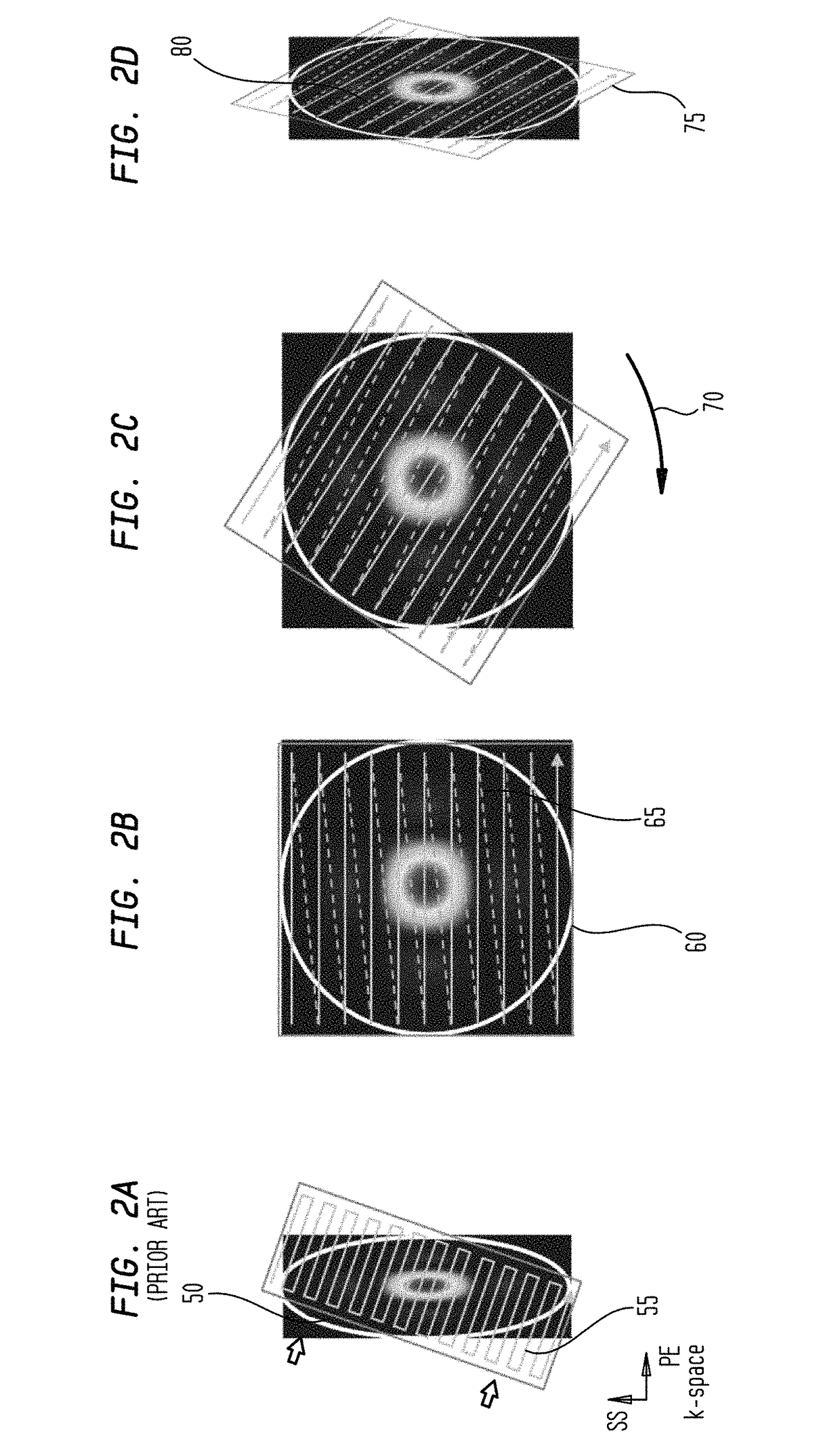 Image domain segmented echo planar magnetic resonance imaging using a 2D excitation radiofrequency pulse