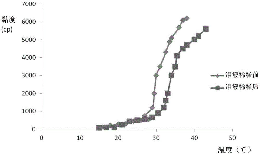 Brinzolamide liposome eye preparation and preparation method thereof