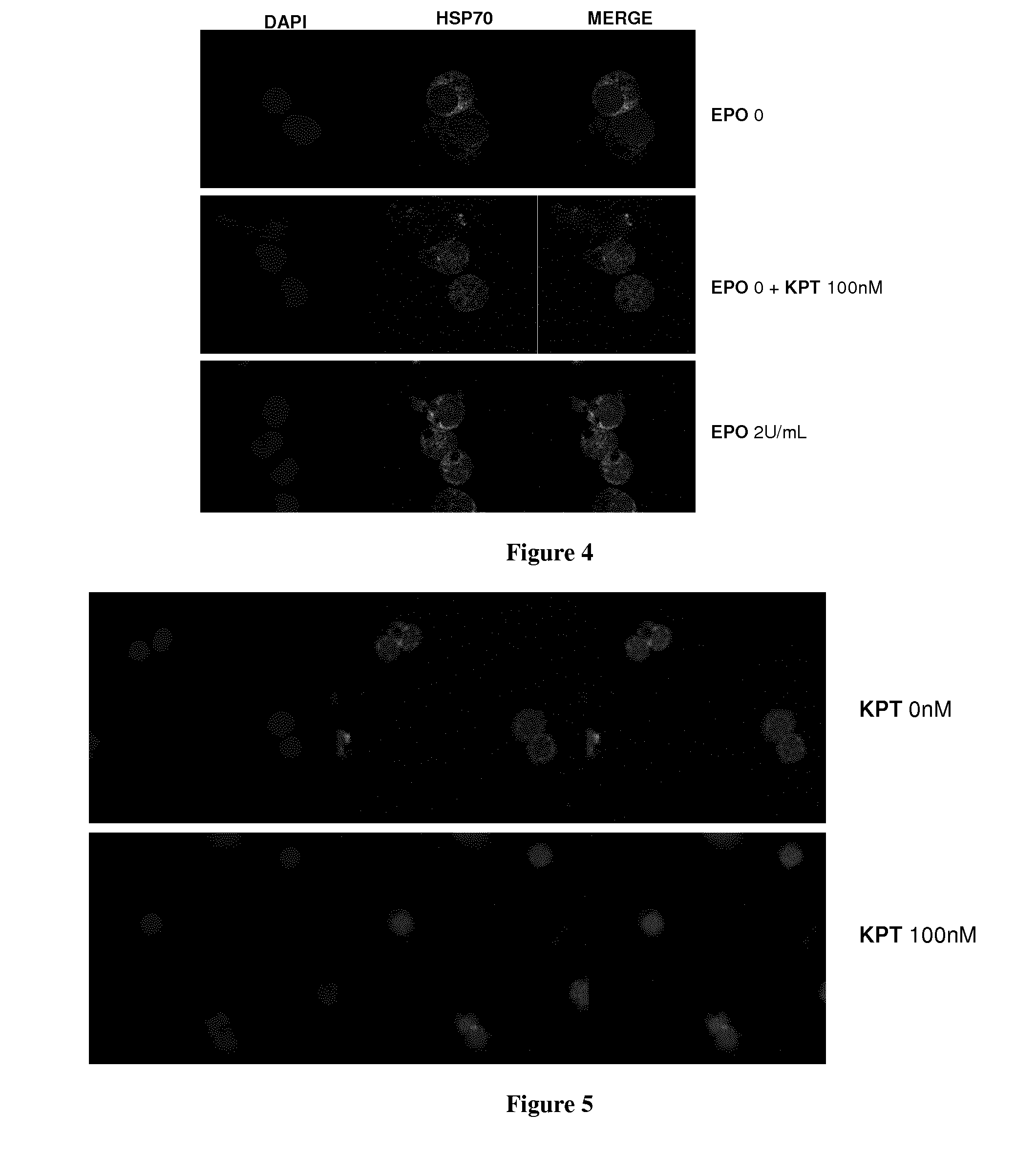 Methods and pharmaceutical compositions for the treatment of beta-thalassemias