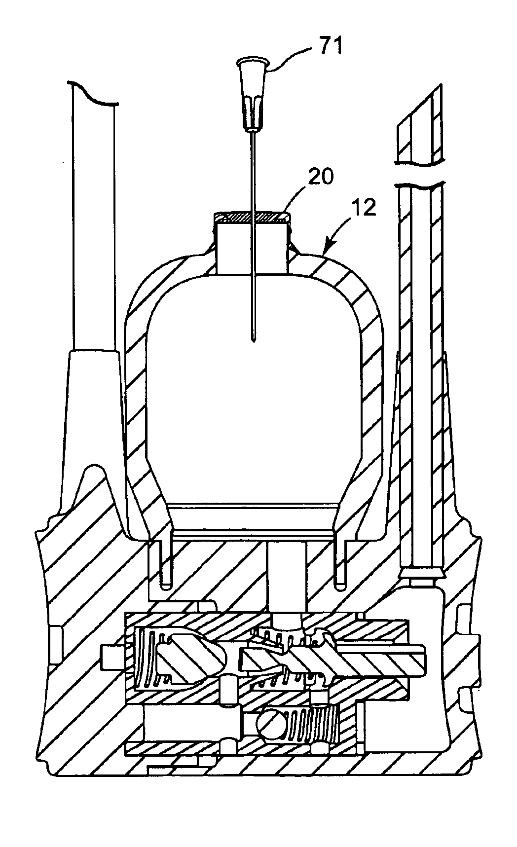 Implantable penile prosthesis fluid transfer systems and methods