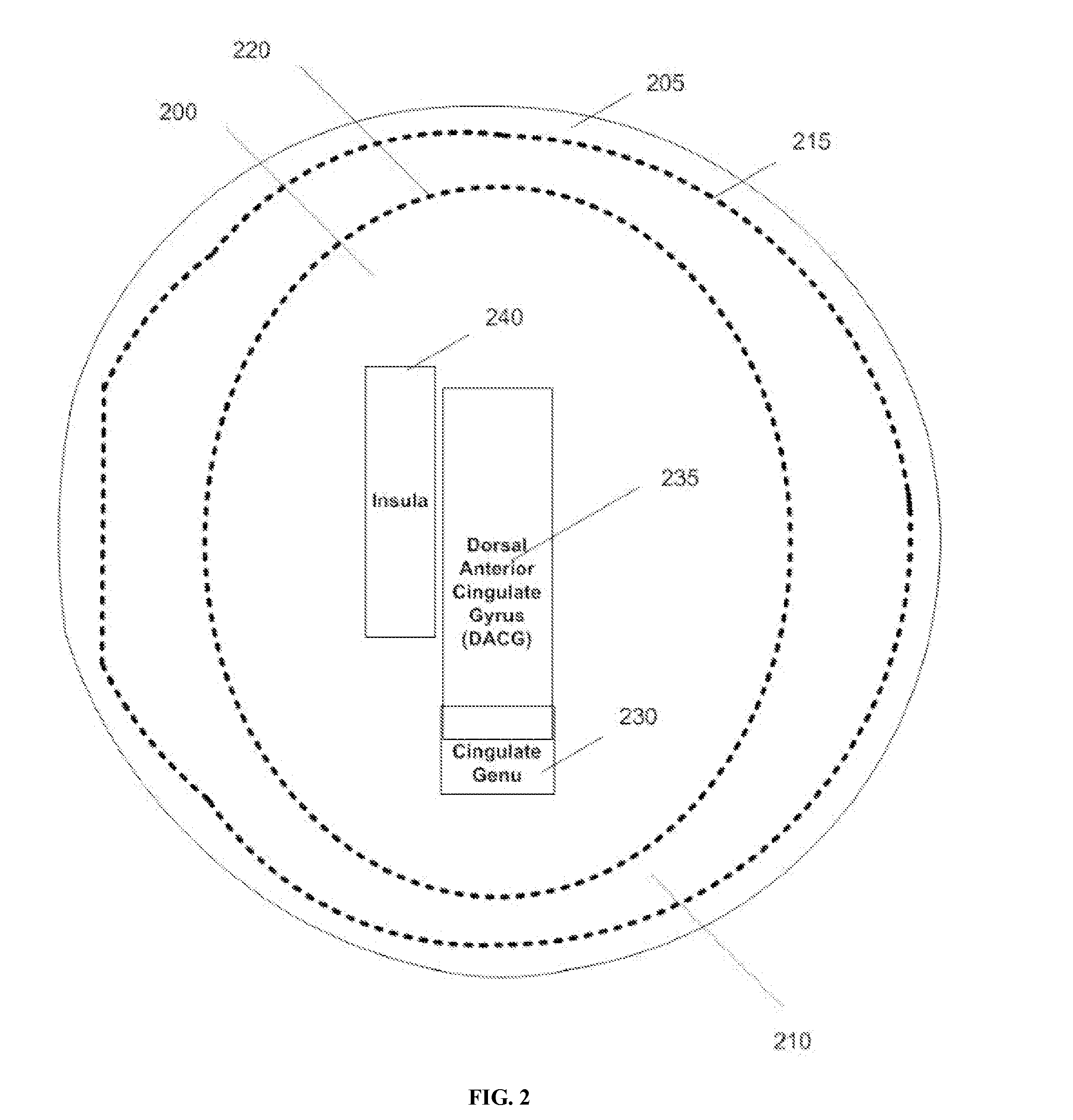 Treatment planning for deep-brain neuromodulation