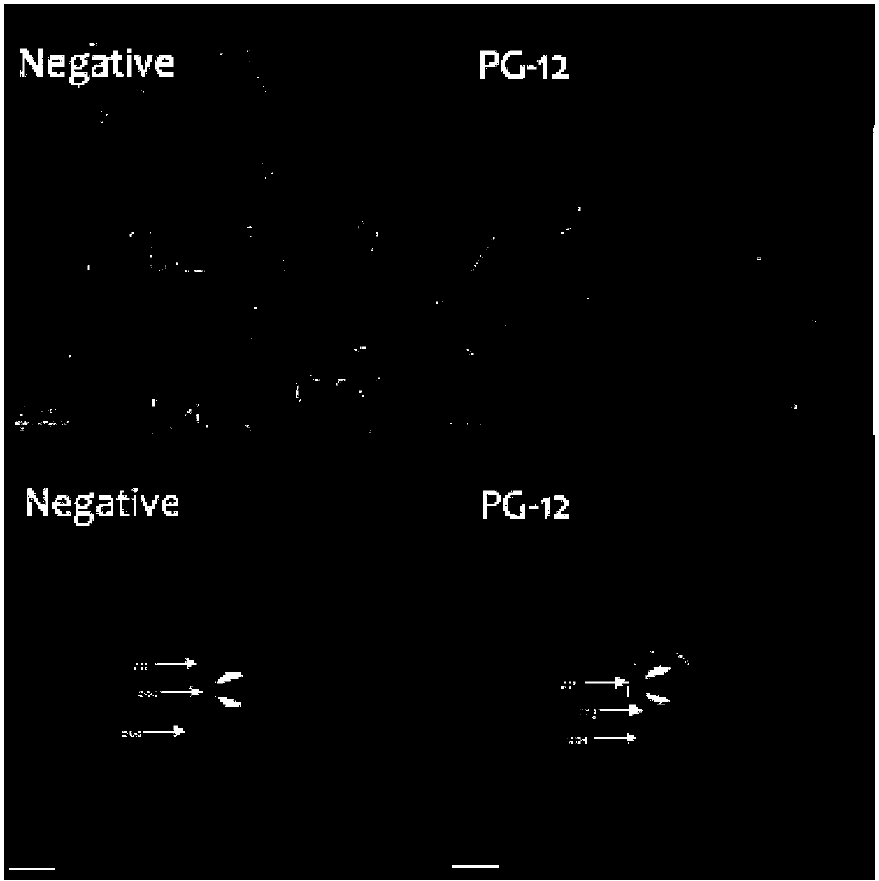 Salivary proline-rich protein bionic anti-caries functional polypeptide, and derivative, salt and application of salivary proline-rich protein bionic anti-caries functional polypeptide