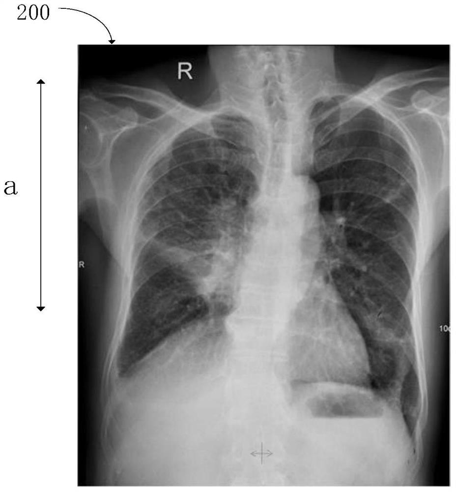 A pet-ct scanning imaging method and related imaging method