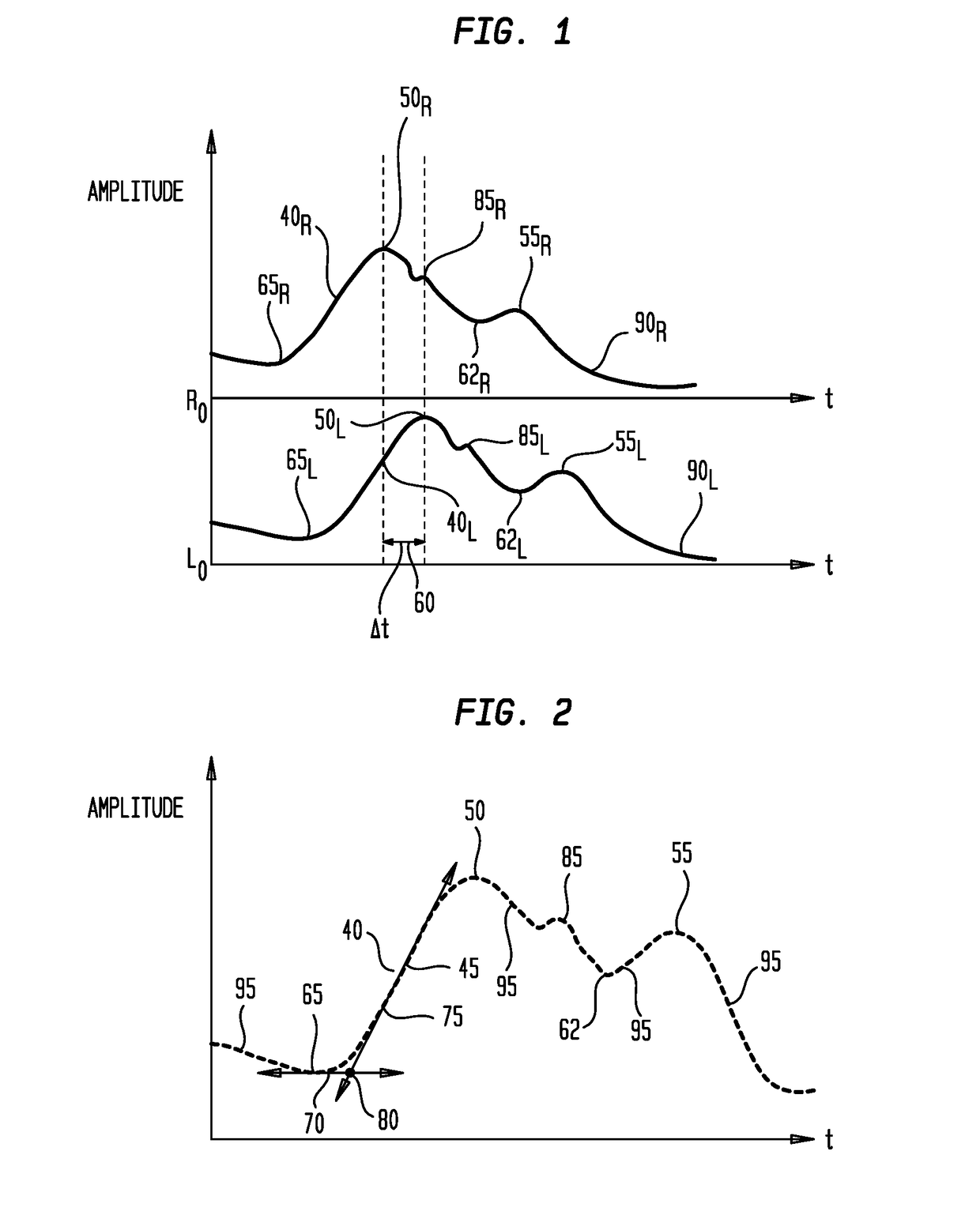 Ambulatory Blood Pressure and Vital Sign Monitoring Apparatus, System and Method