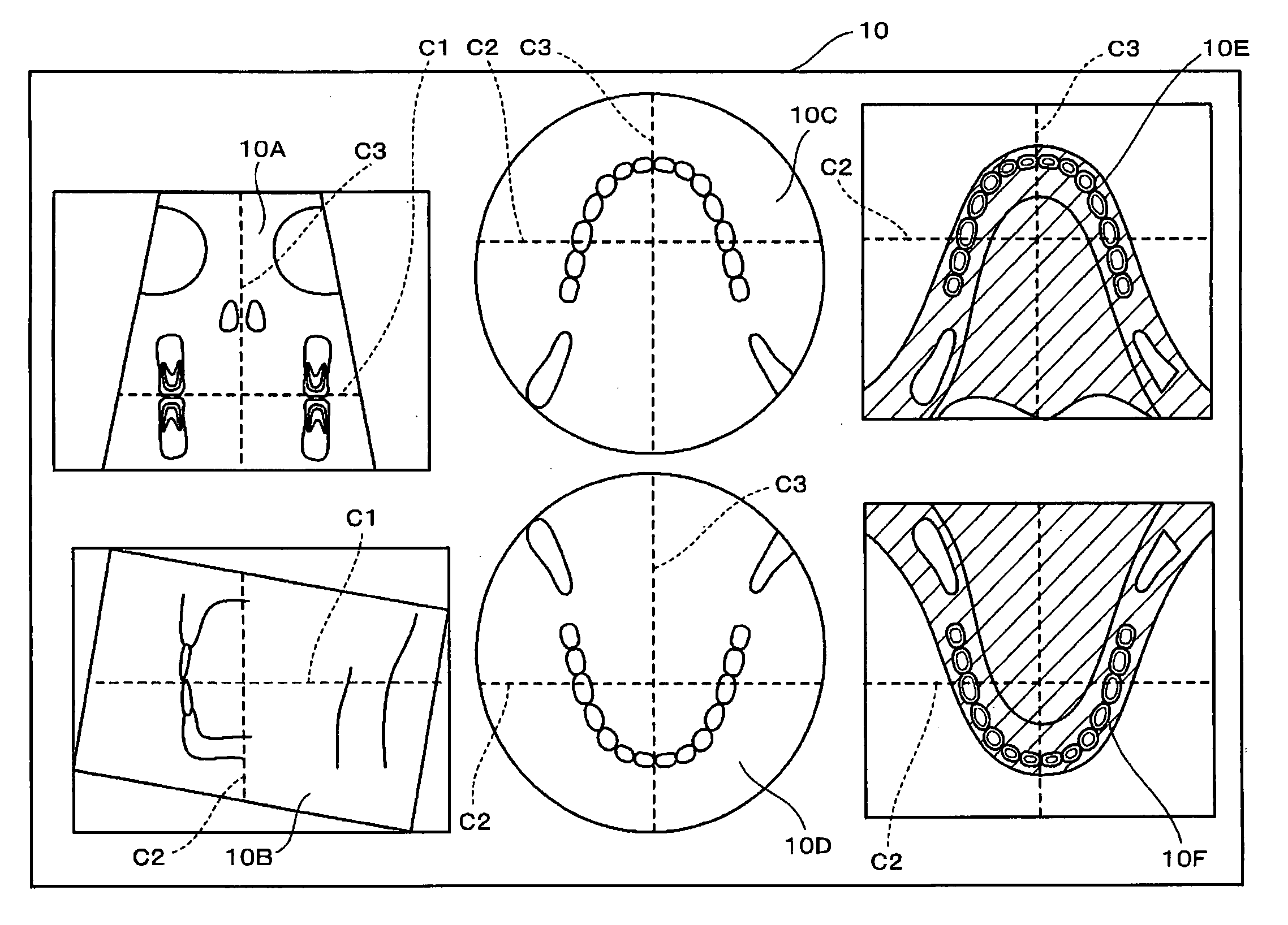 X-ray CT imaging displaying method, X-ray CT image displaying apparatus, and X-ray CT apparatus