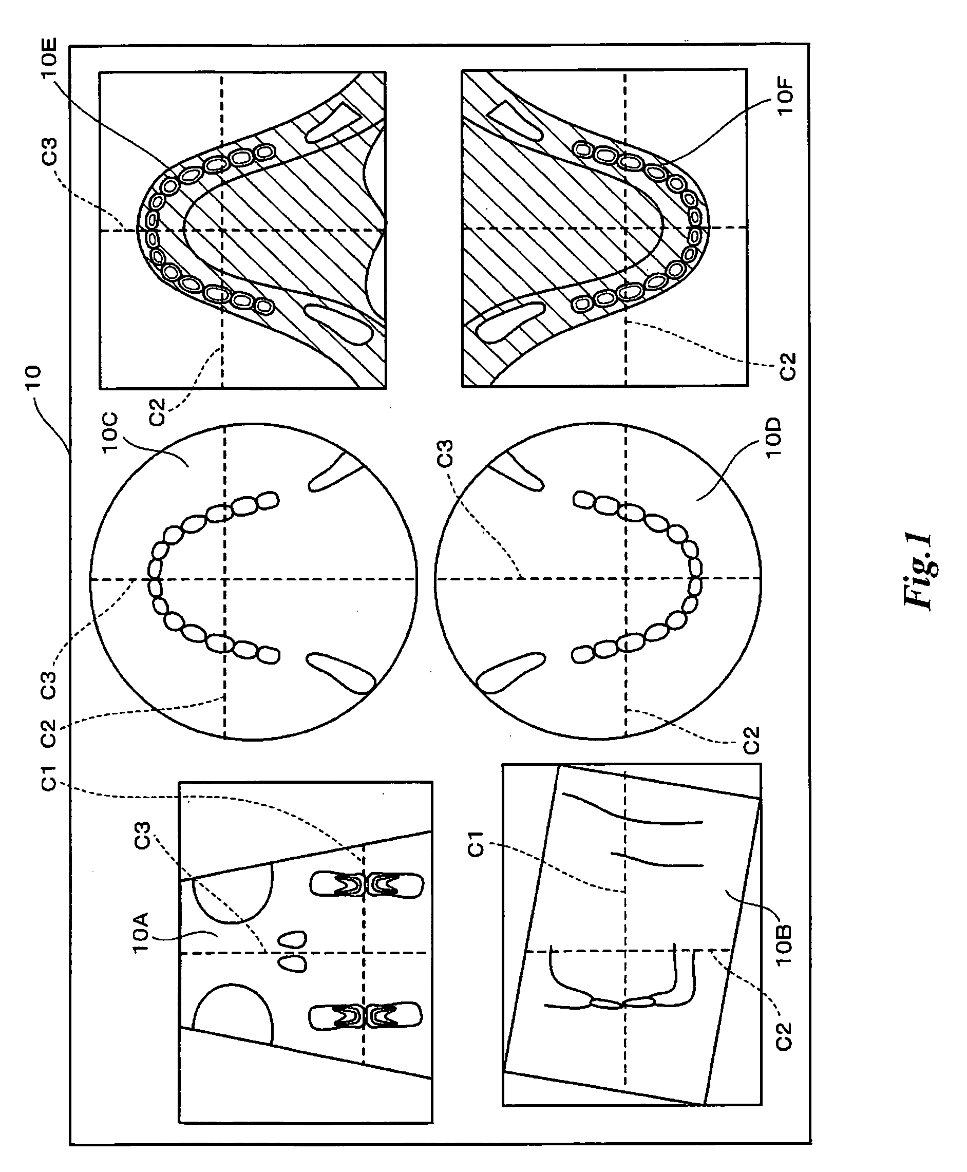 X-ray CT imaging displaying method, X-ray CT image displaying apparatus, and X-ray CT apparatus