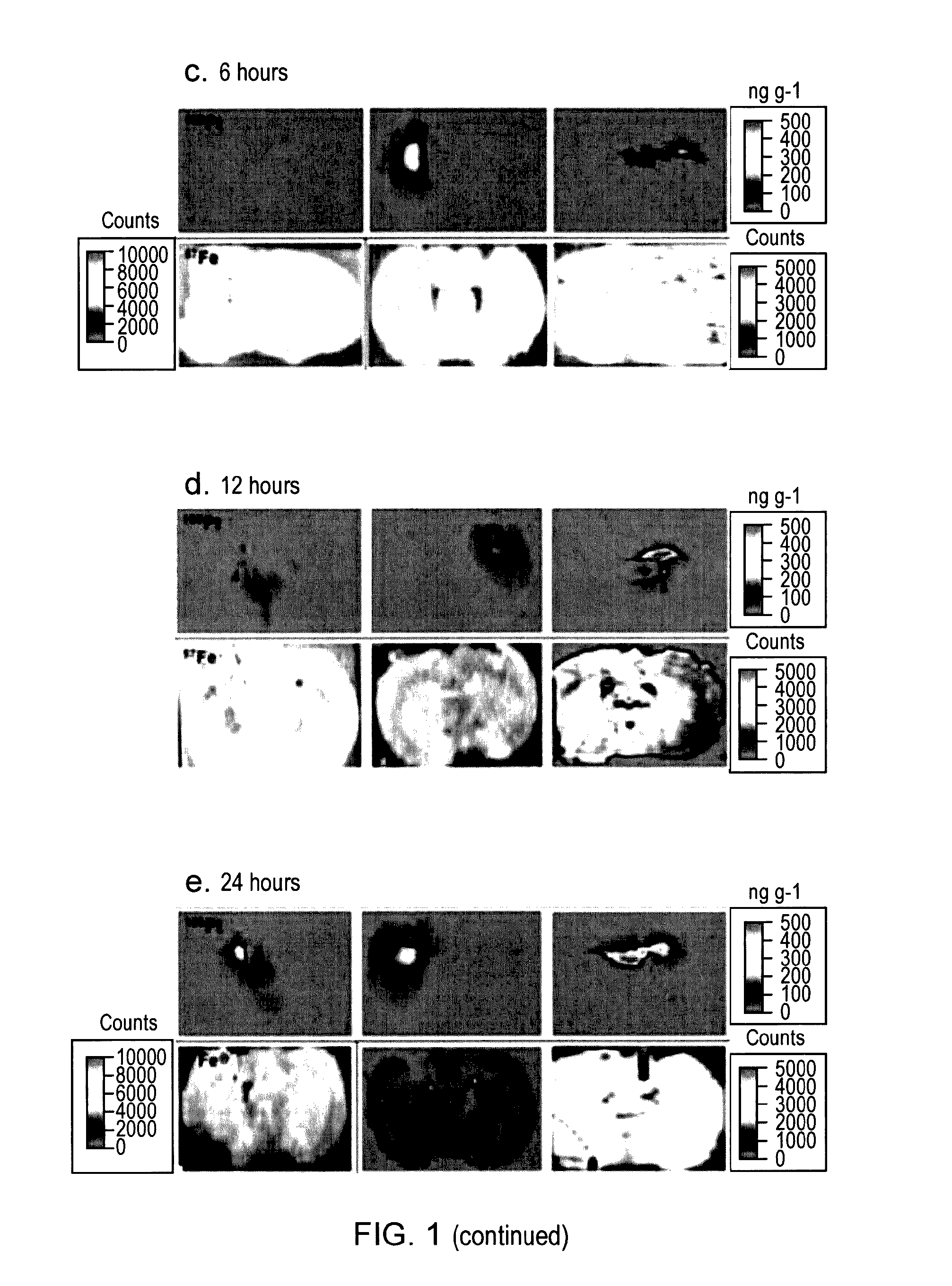 Glioma treatment