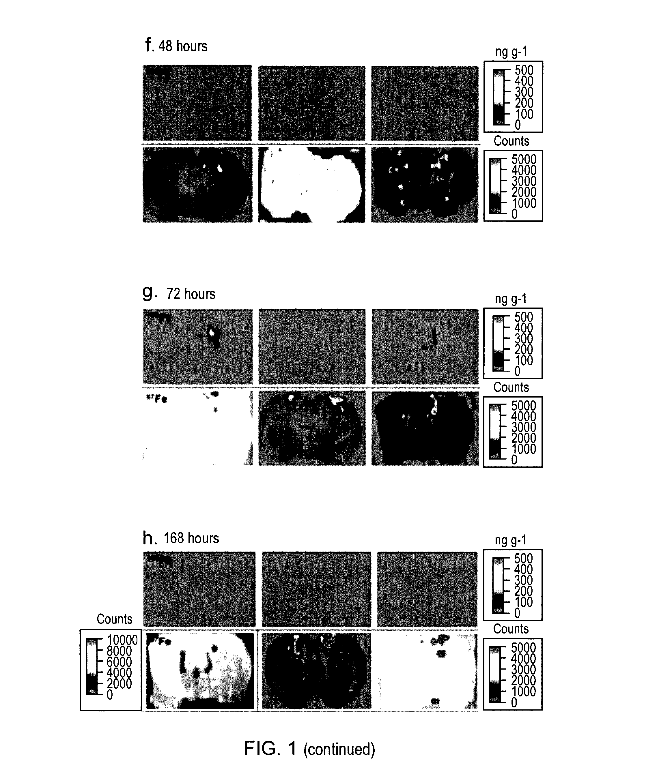 Glioma treatment