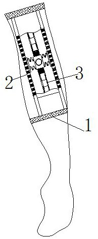 A nursing device for cancer pain caused by malignant blood tumors in the elderly