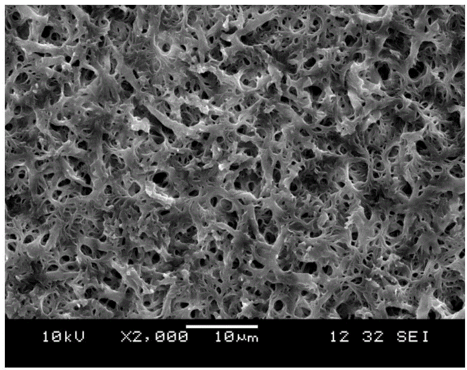 Scaffold containing platelets and hyaluronic acid and preparation method of scaffold