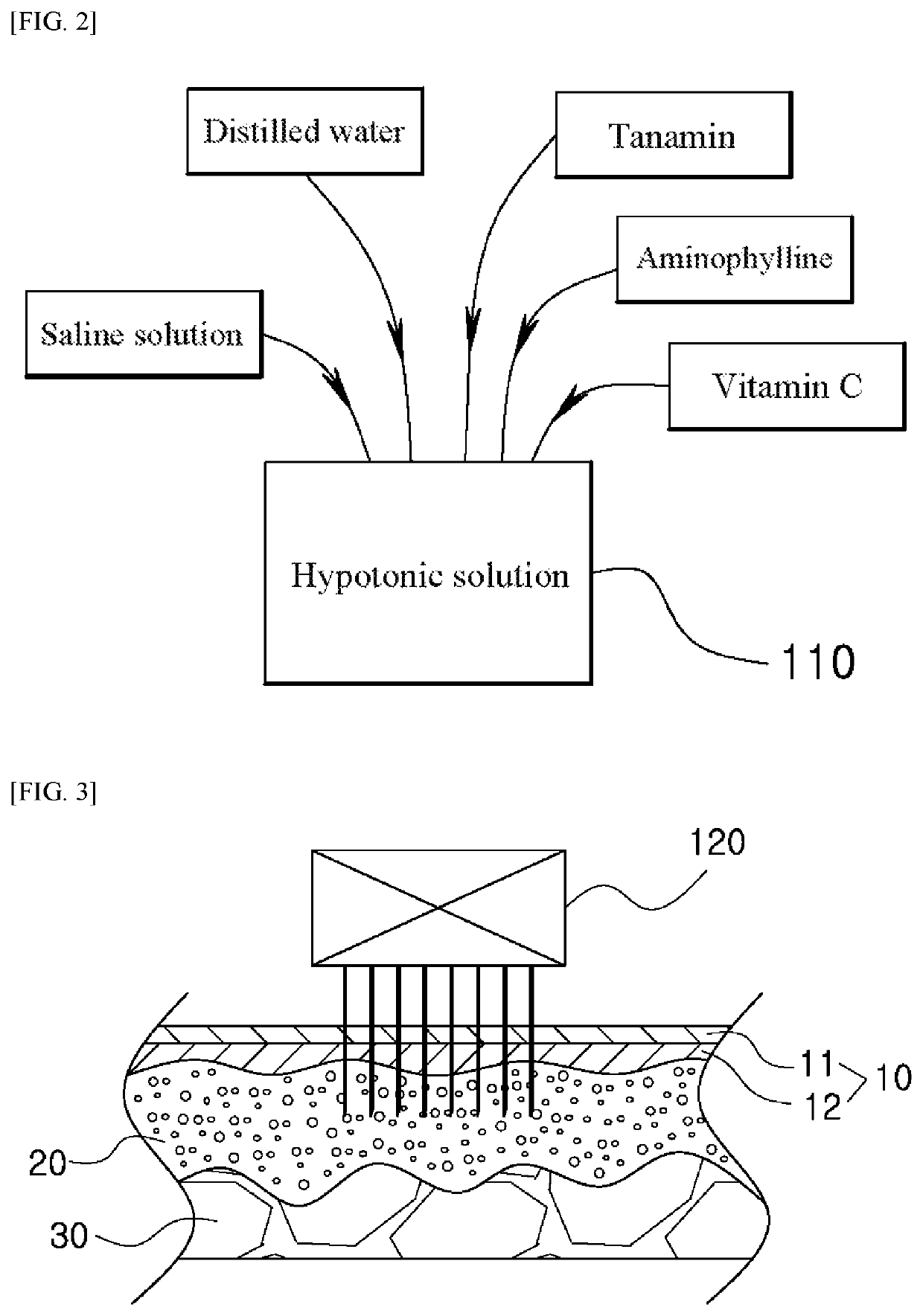 Localized fat destroying method and hypotonic solution for destroying localized fat