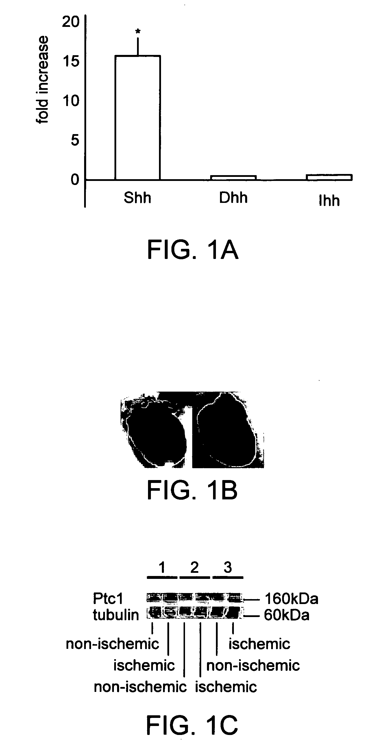 Morphogen compositions and methods of use thereof to treat heart disorders