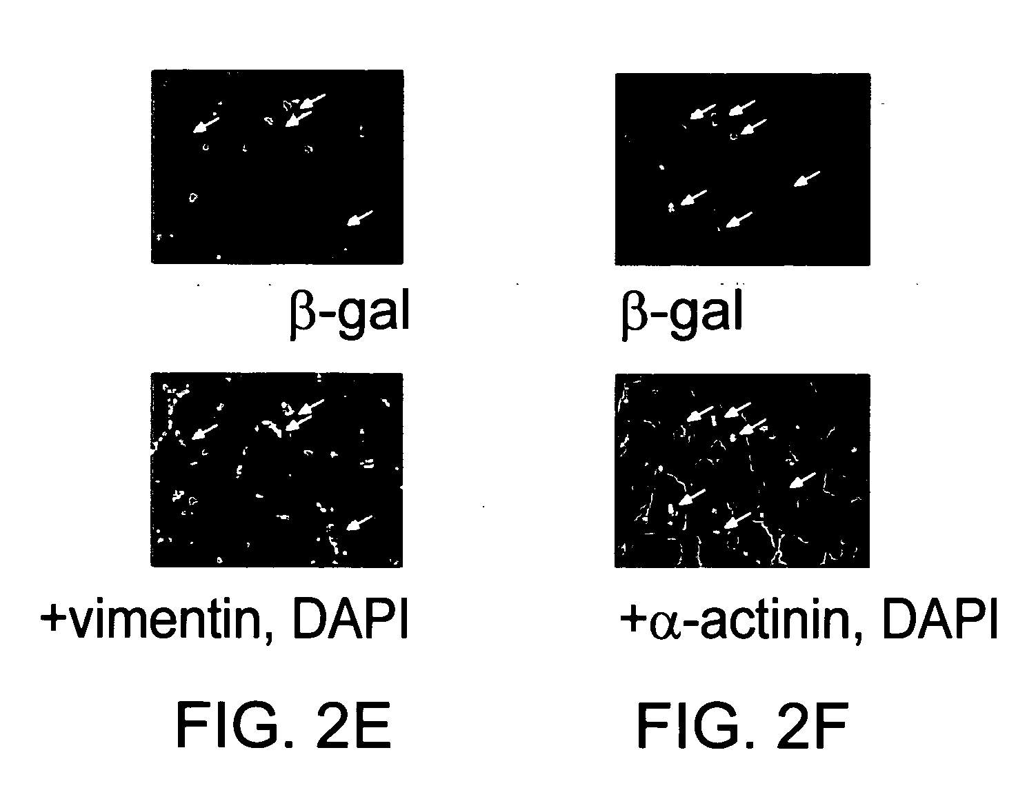 Morphogen compositions and methods of use thereof to treat heart disorders