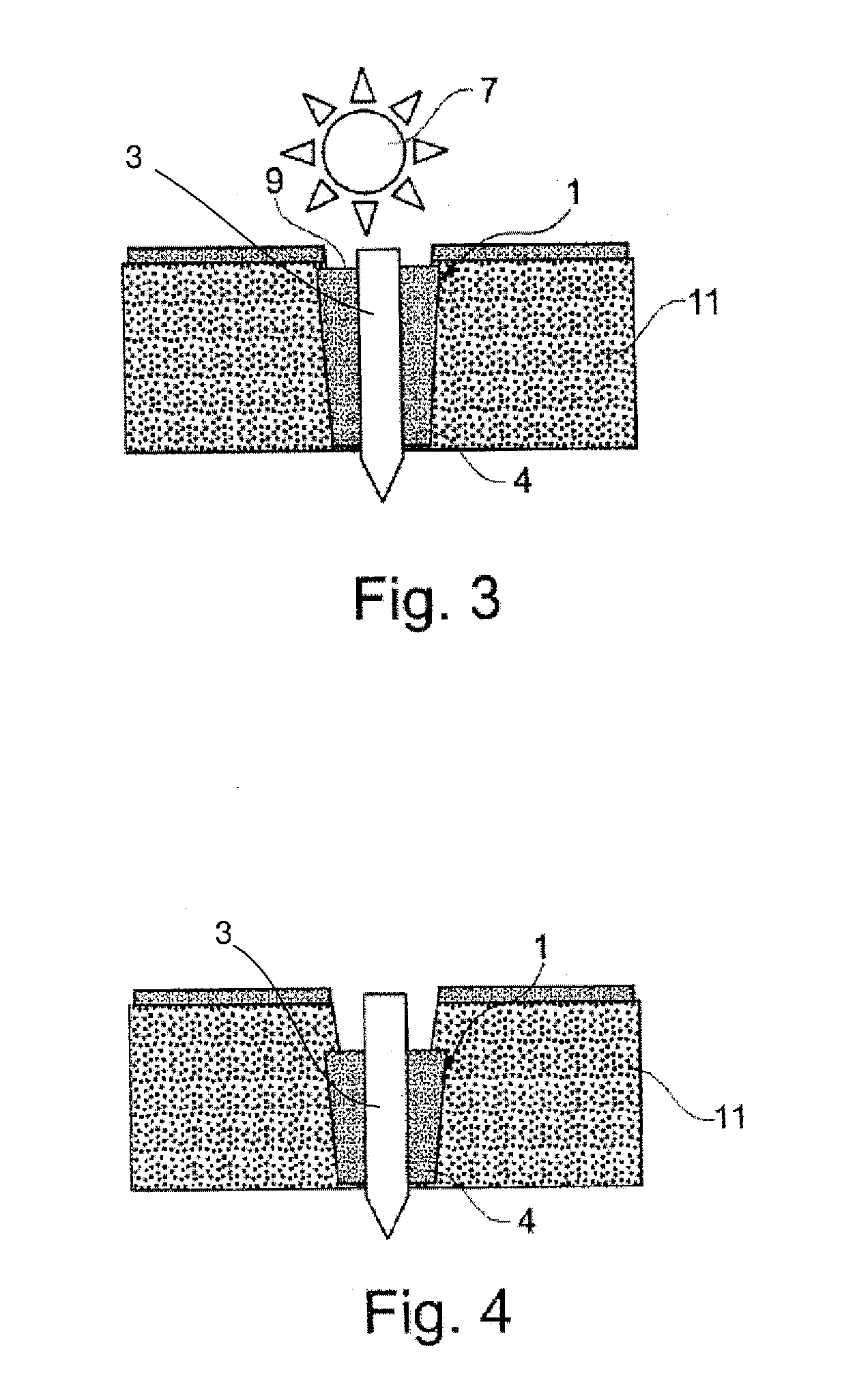 Fixation Device With Magnesium Core