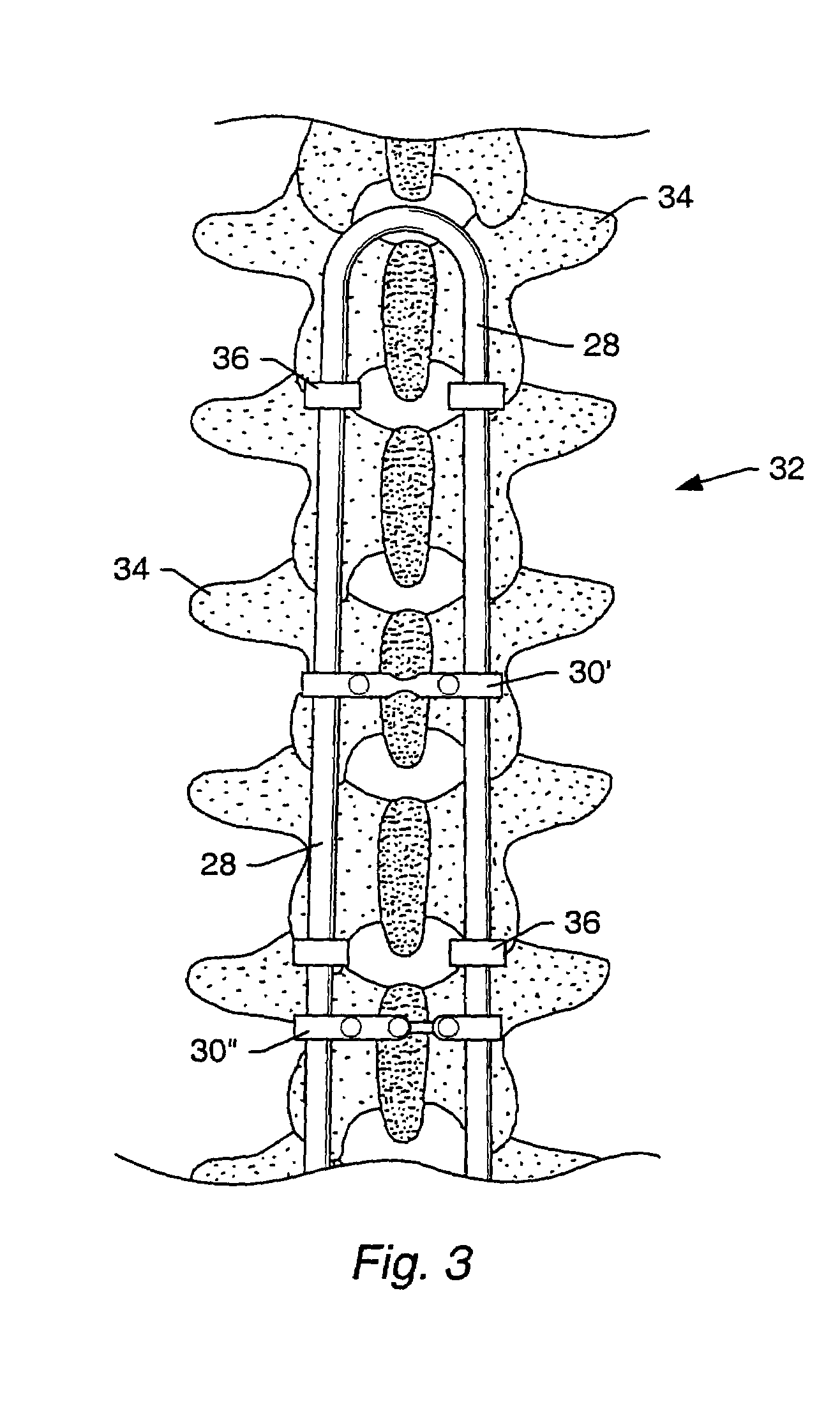 Transverse connector with cam activated engagers