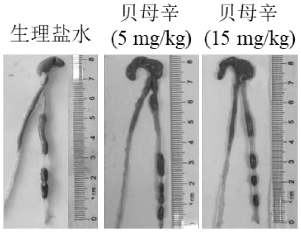 Application of peimisine in preparation of medicine for preventing and/or treating ulcerative colitis