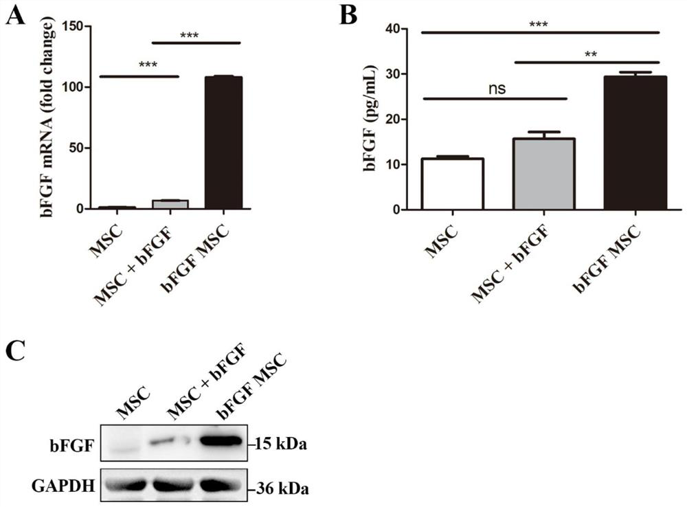 bFGF mesenchymal stem cell exosome as well as preparation method and application thereof