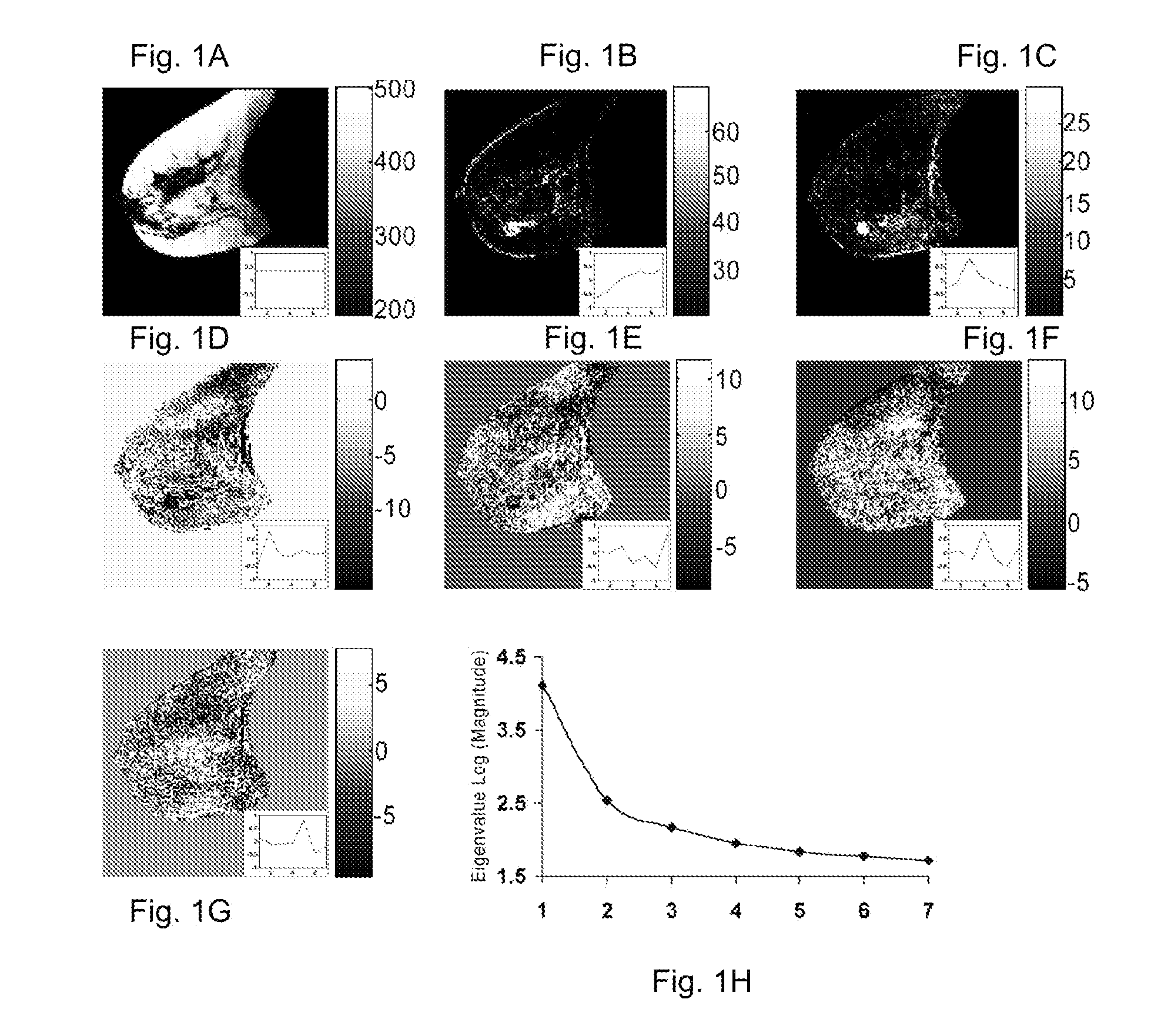 Method and apparatus for computer-aided diagnosis of cancer and product