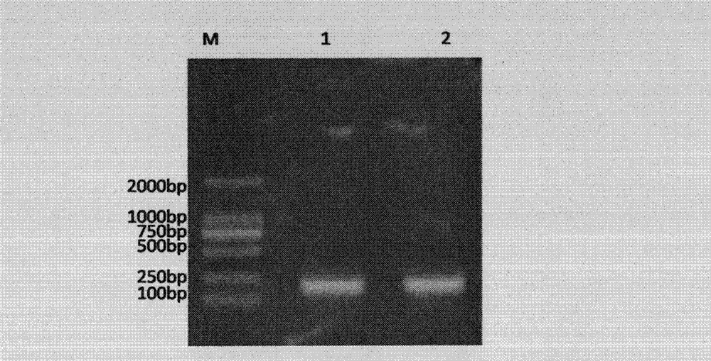 Novel preparation method for recombinant human epidermal growth factor