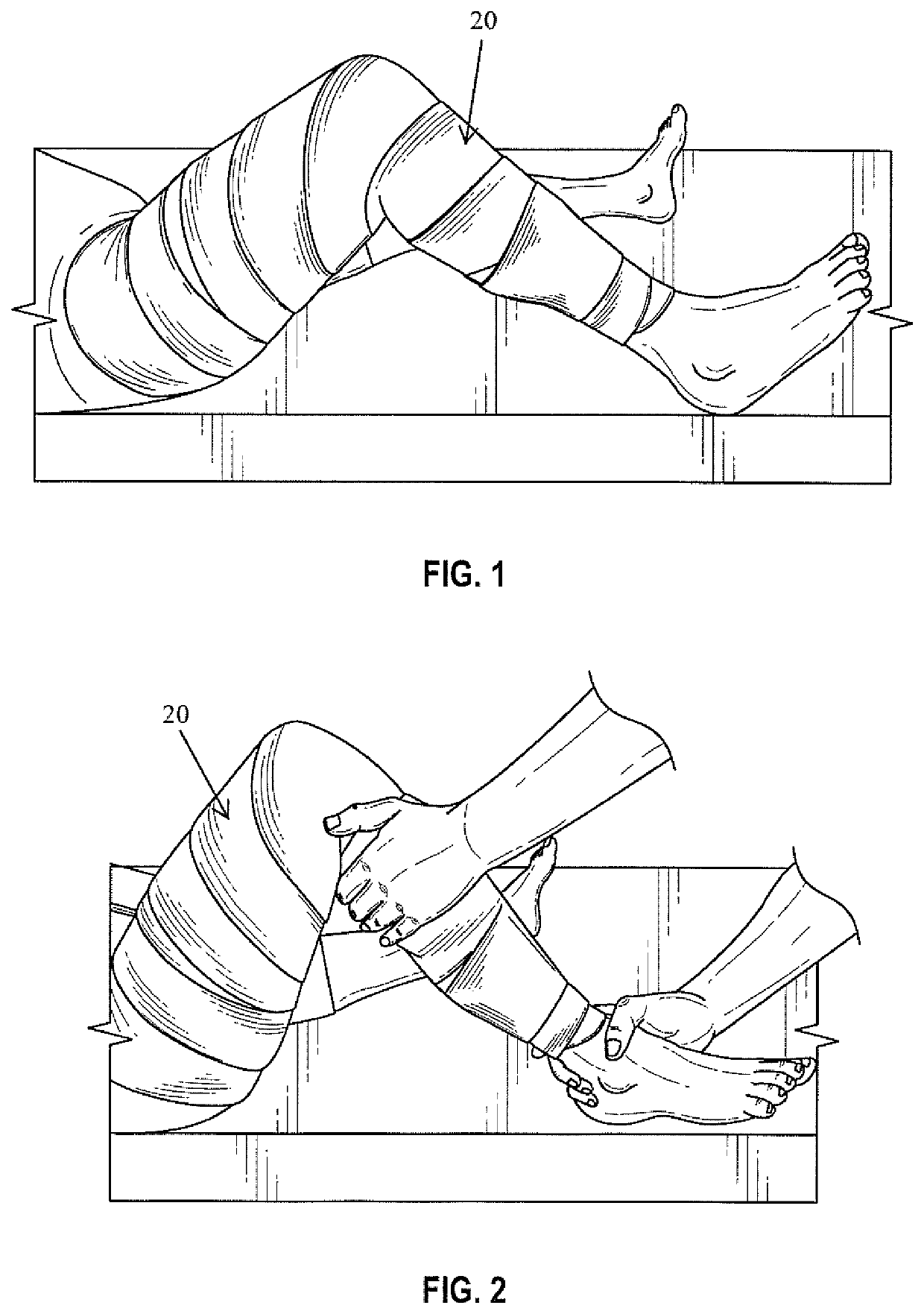 Method for producing a negative cast for a brace with corrective forces to control PLC deficiencies