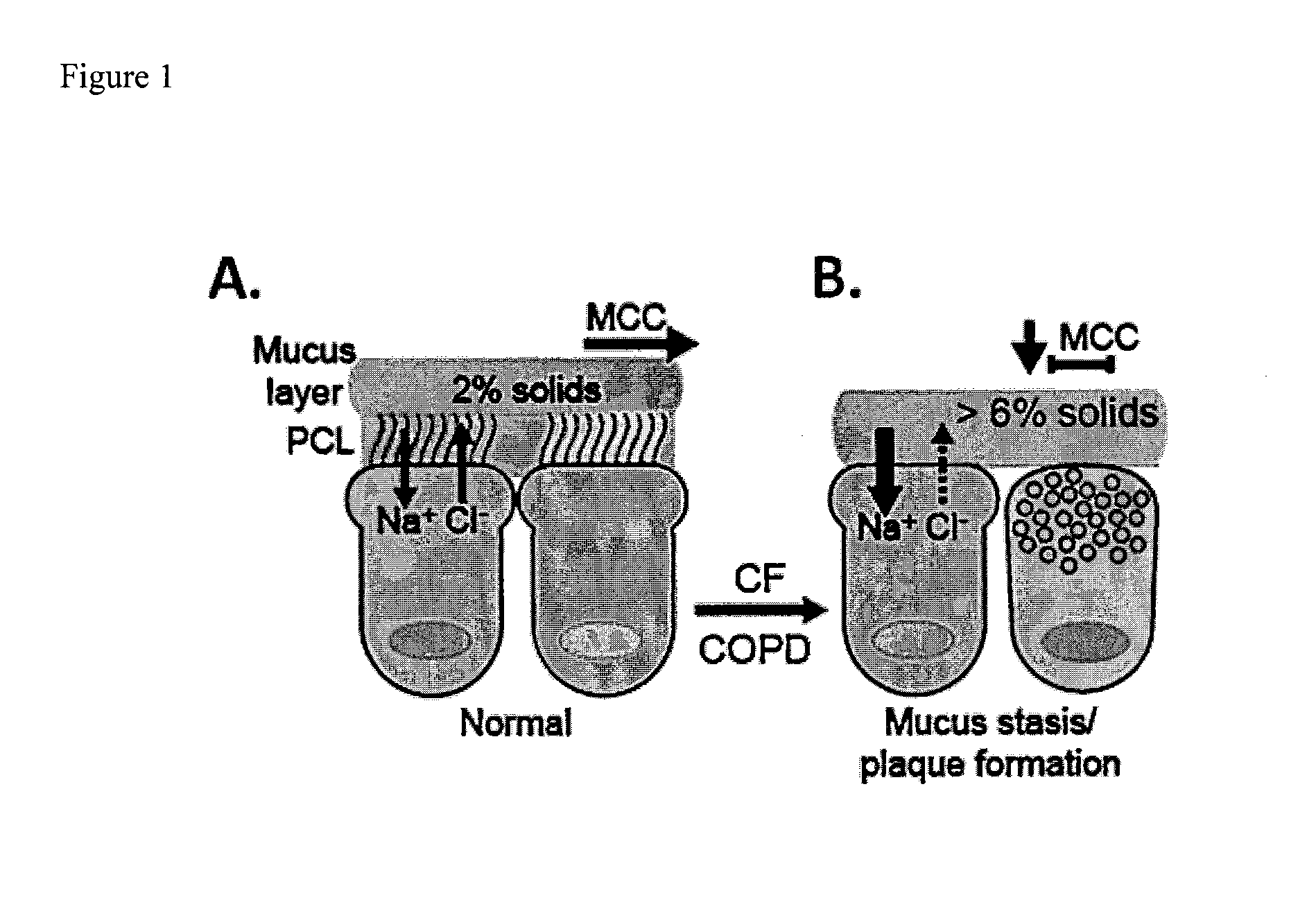 Dithiol mucolytic agents