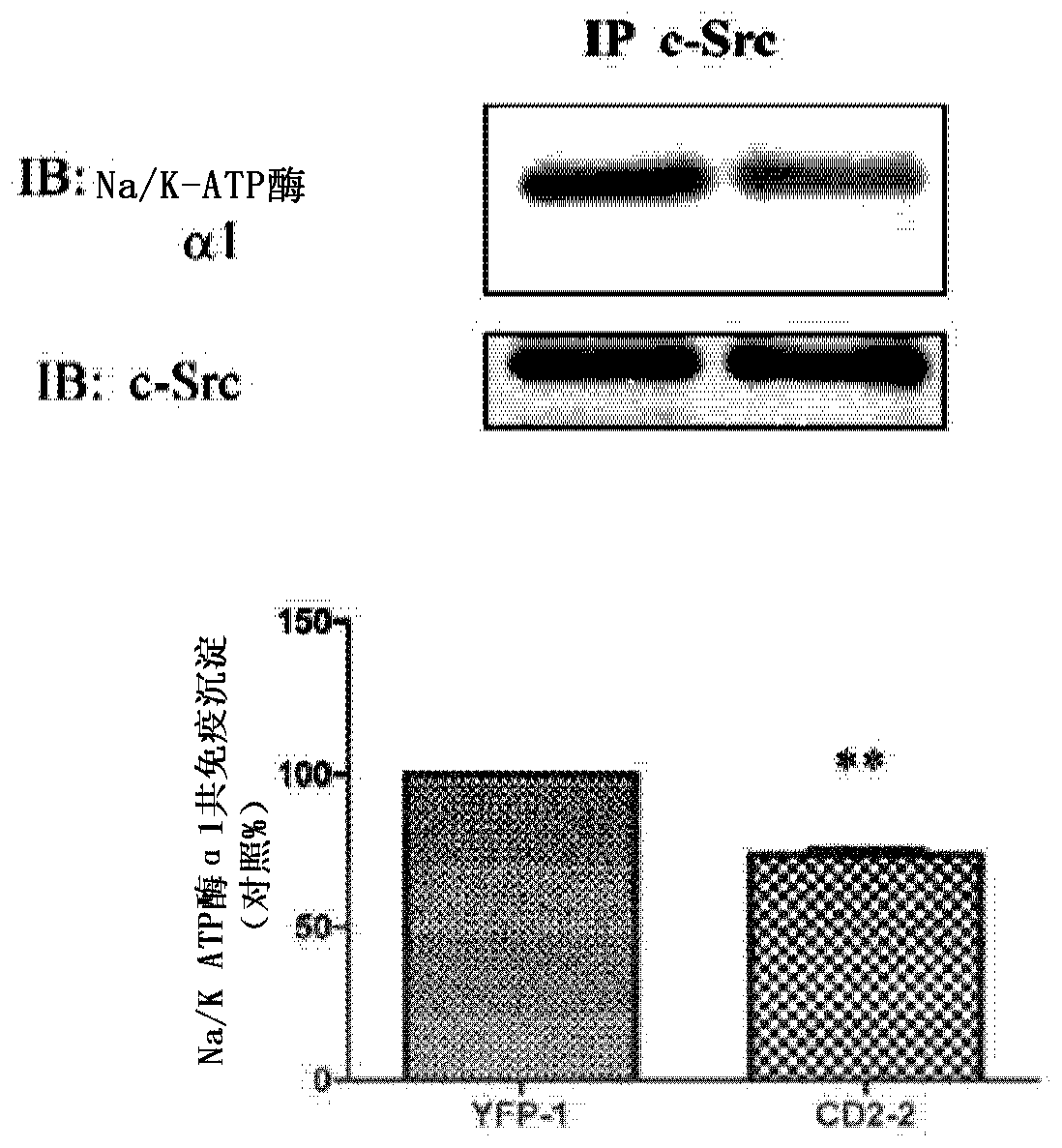 Cardiac steroid antagonists and related methods