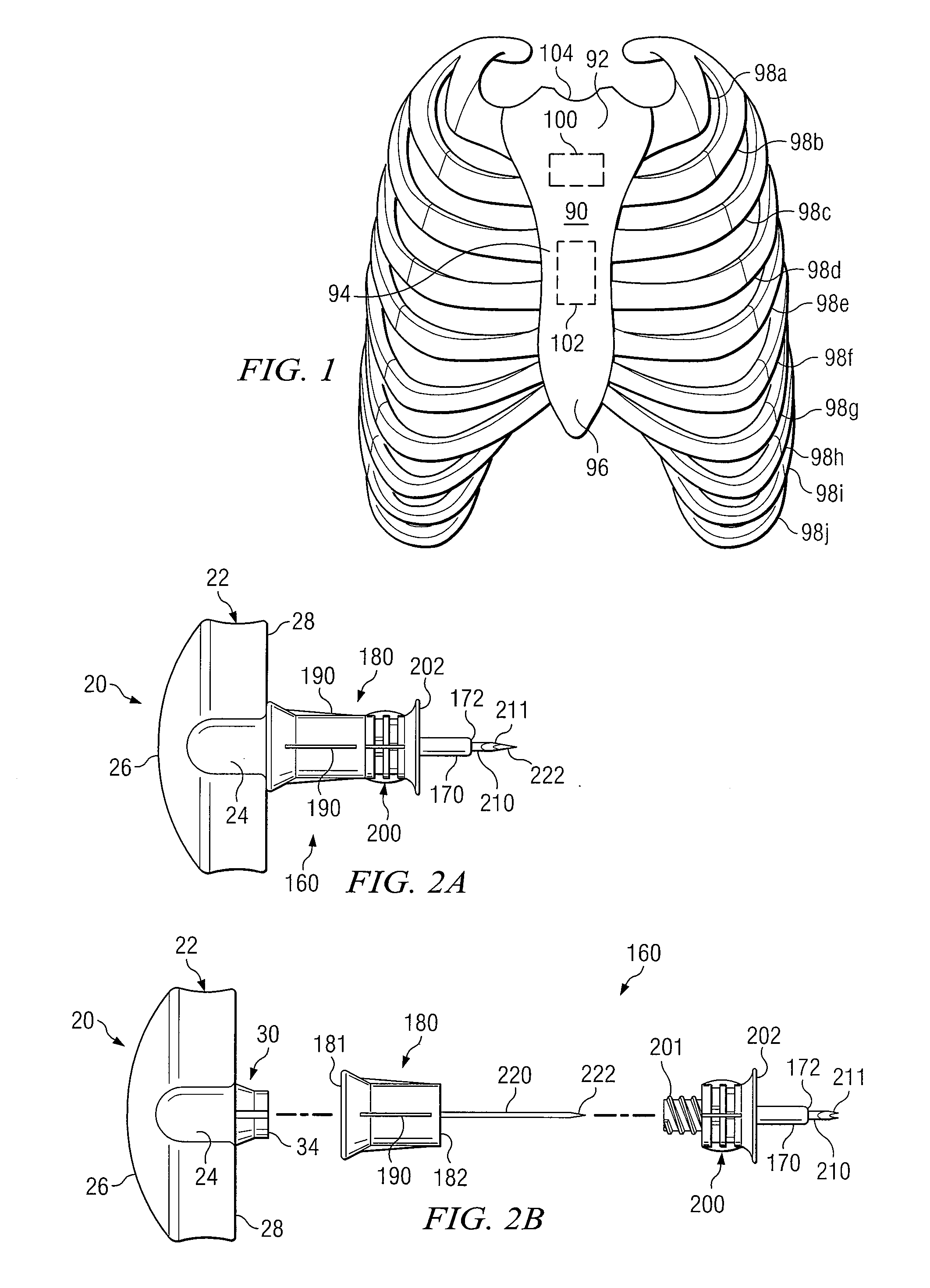 Intraosseous Device And Methods For Accessing Bone Marrow In The Sternum And Other Target Areas