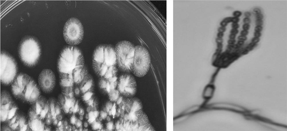 A strain of Penicillium bilaii mp6 with antibacterial effect and its application