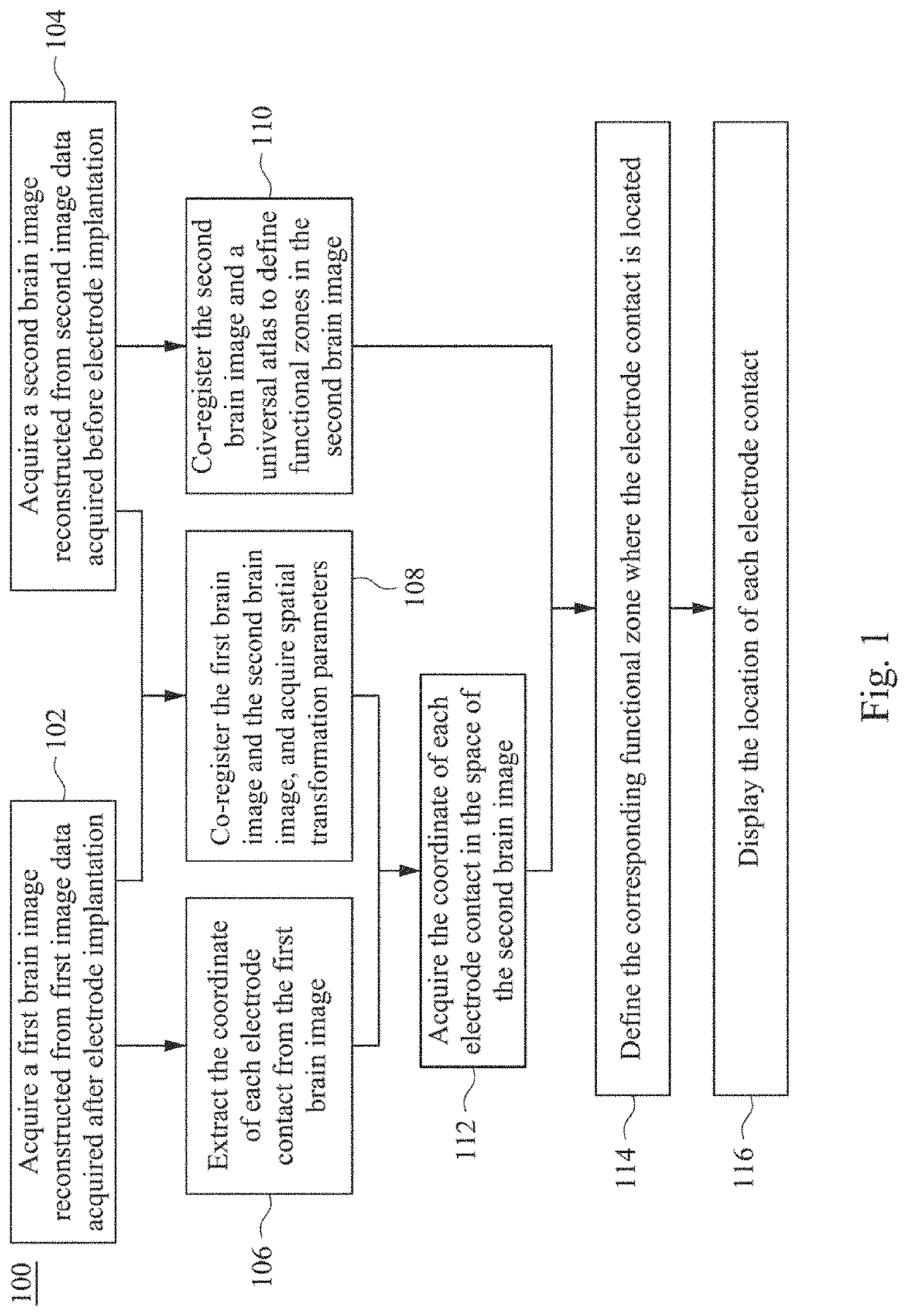 Method and system for localizing implanted intracranial electrode