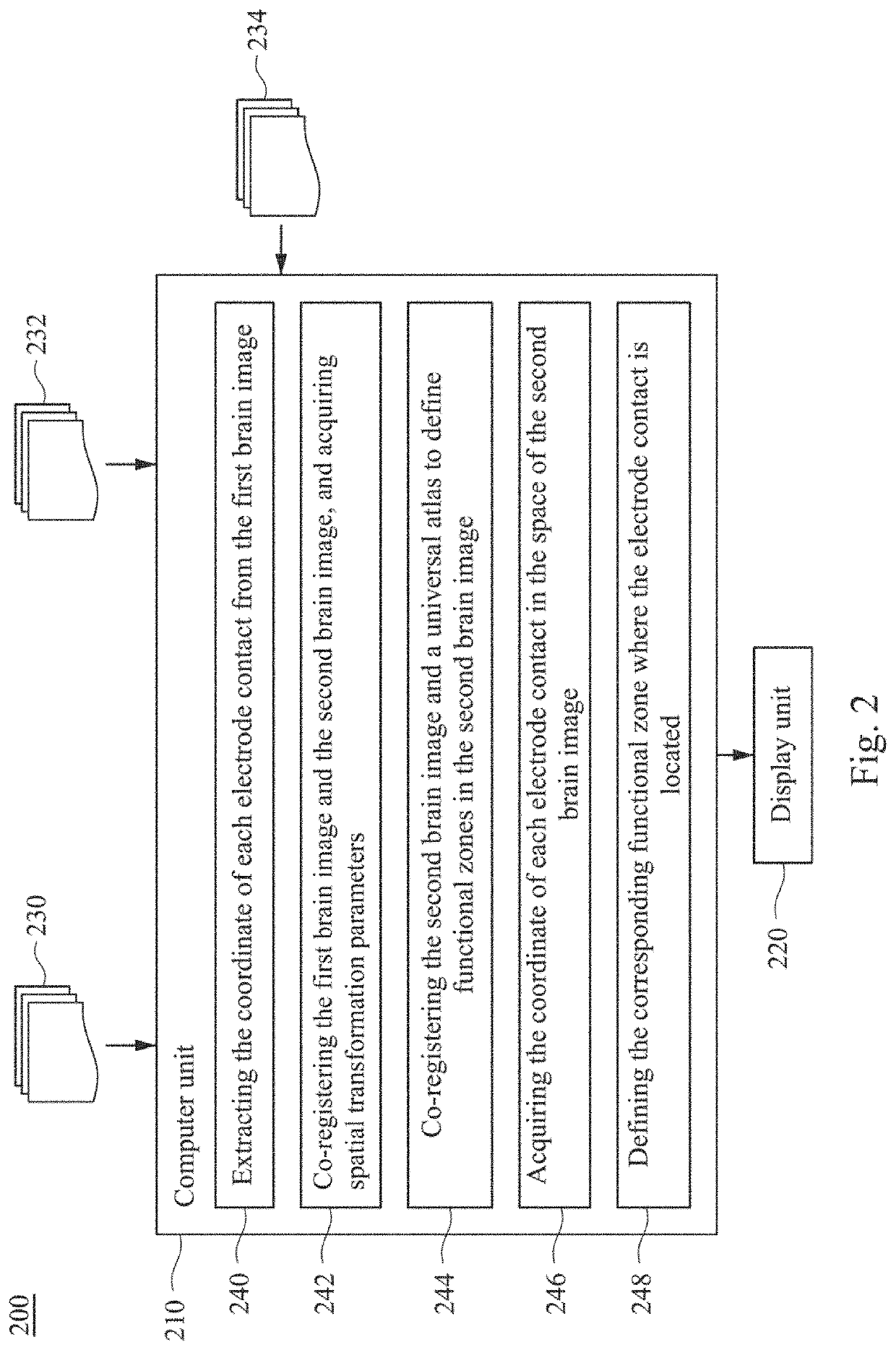 Method and system for localizing implanted intracranial electrode