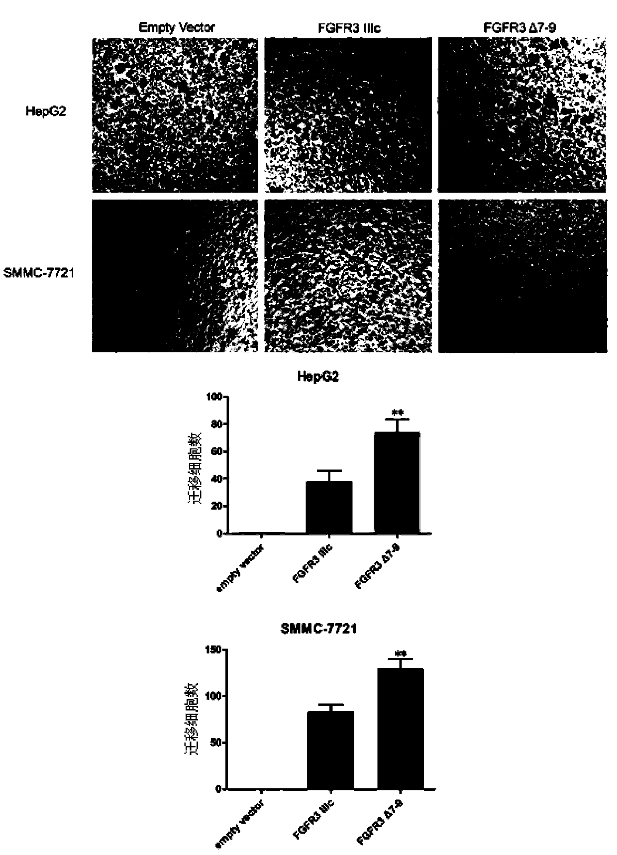 Novel splice variant of FGFR3 (Fibroblast Growth Factor Receptor 3) in liver carcinoma tissue and application thereof