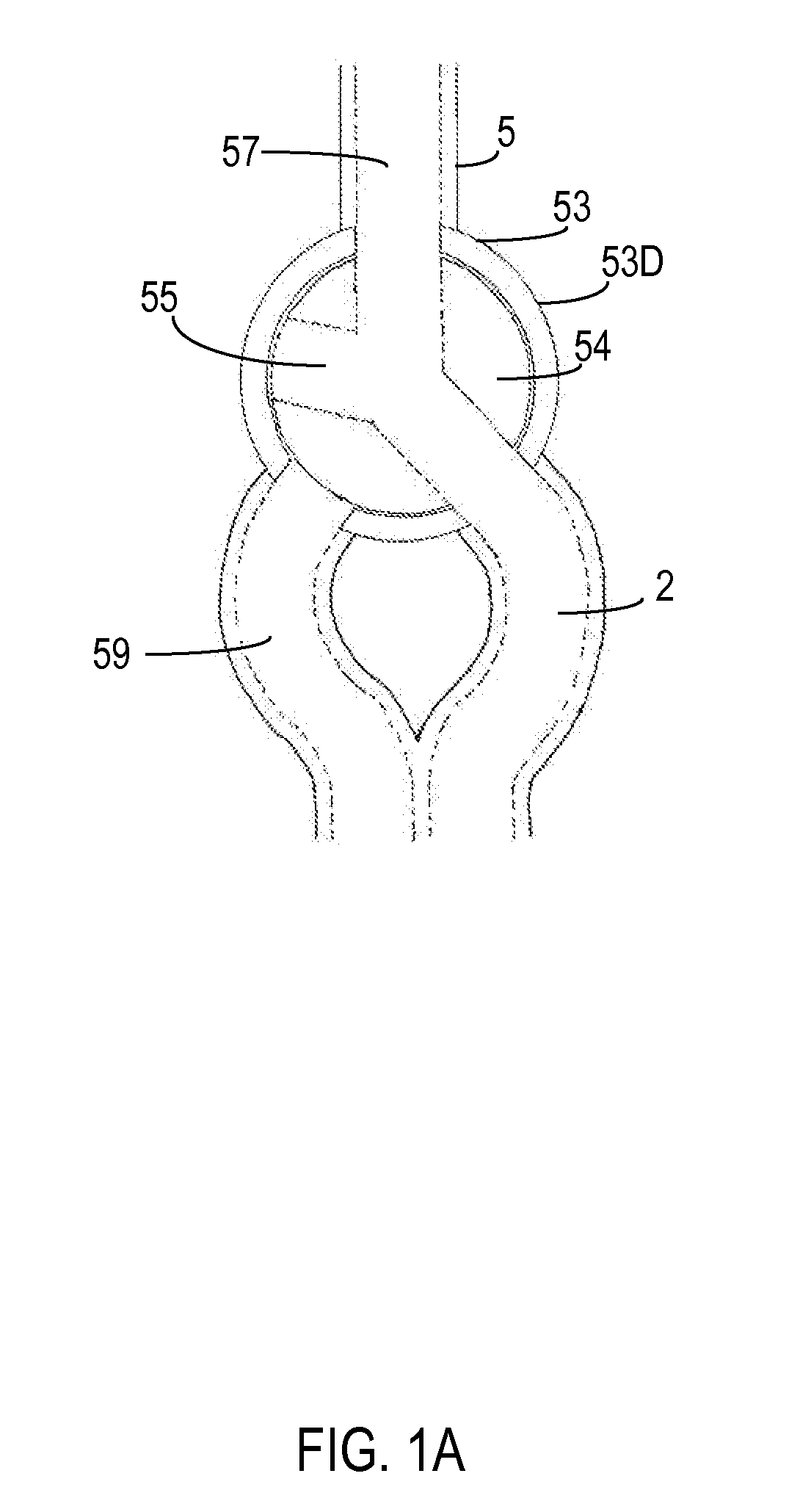 Endotracheal tube with intrinsic suction & endotracheal suction control valve